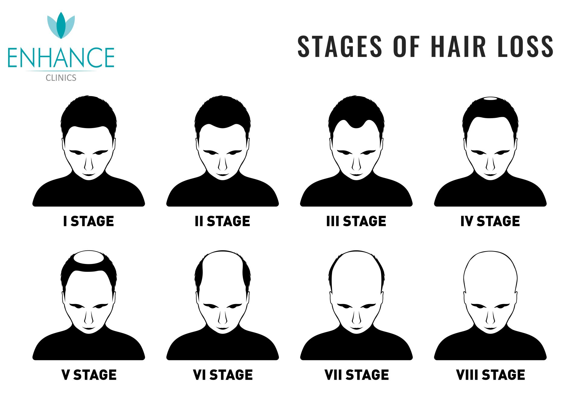 Stages of Hair Transplant Stages of Hair Transplant