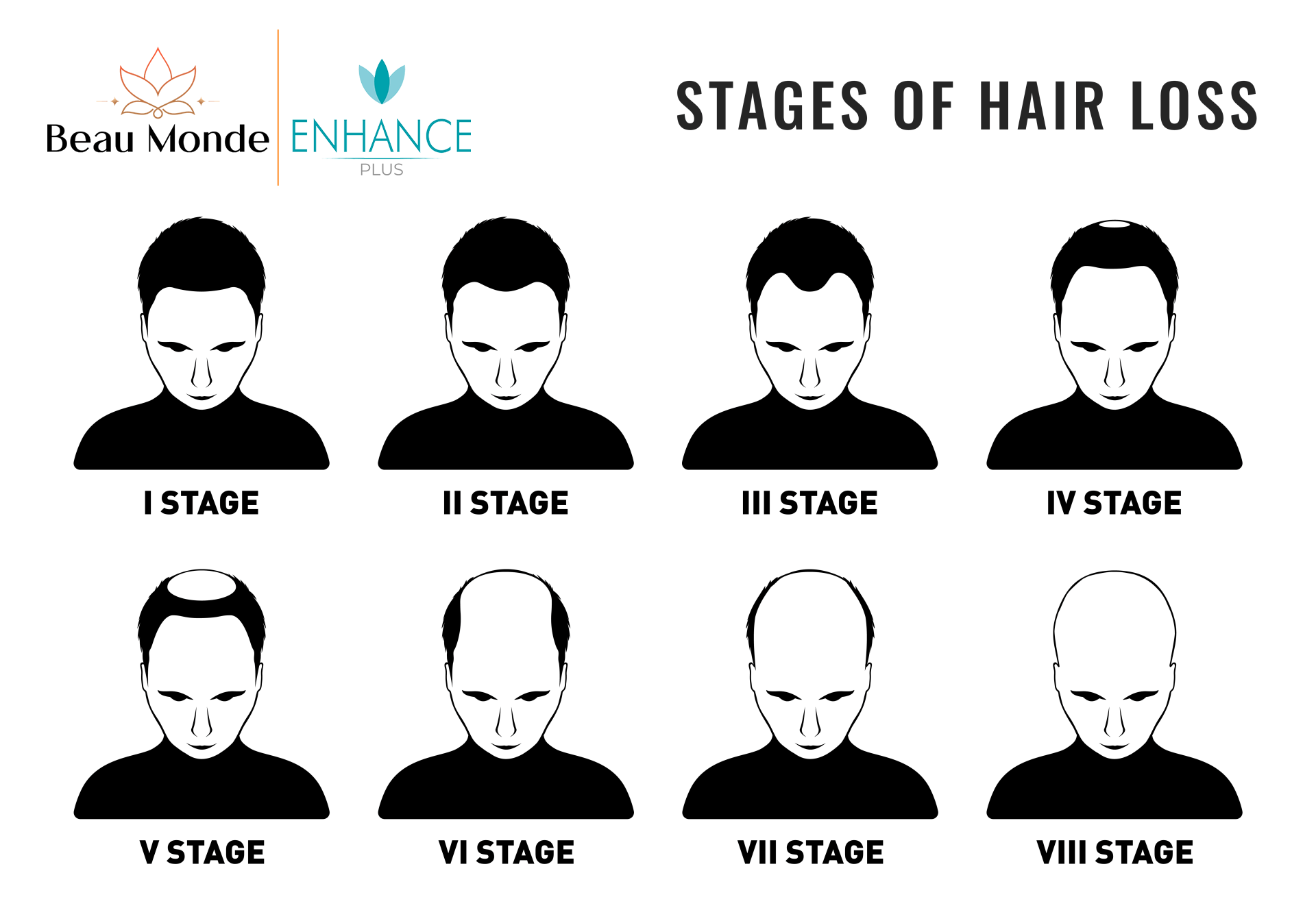 Stages-of-Hair-Transplant-1-1 Stages of Hair Loss
